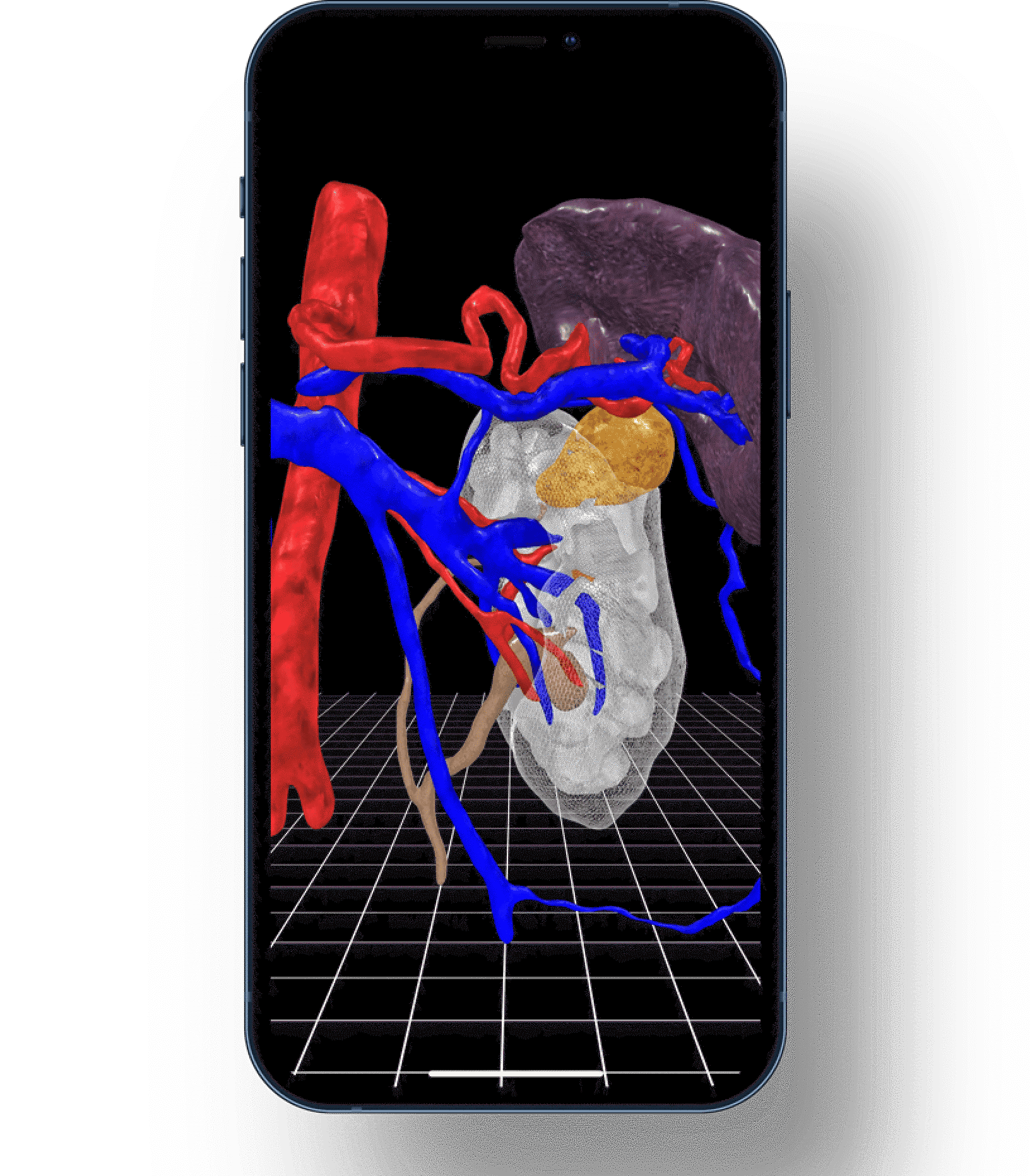 What Does Ceevra, Inc. Do?